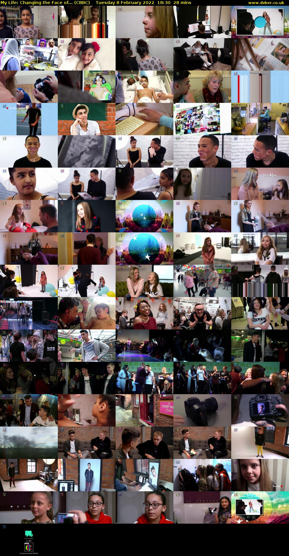 My Life: Changing the Face of... (CBBC) Tuesday 8 February 2022 18:30 - 18:58