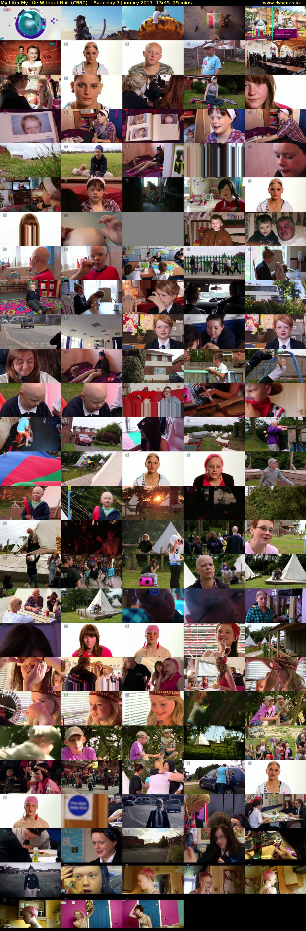 My Life: My Life Without Hair (CBBC) Saturday 7 January 2017 13:45 - 14:10