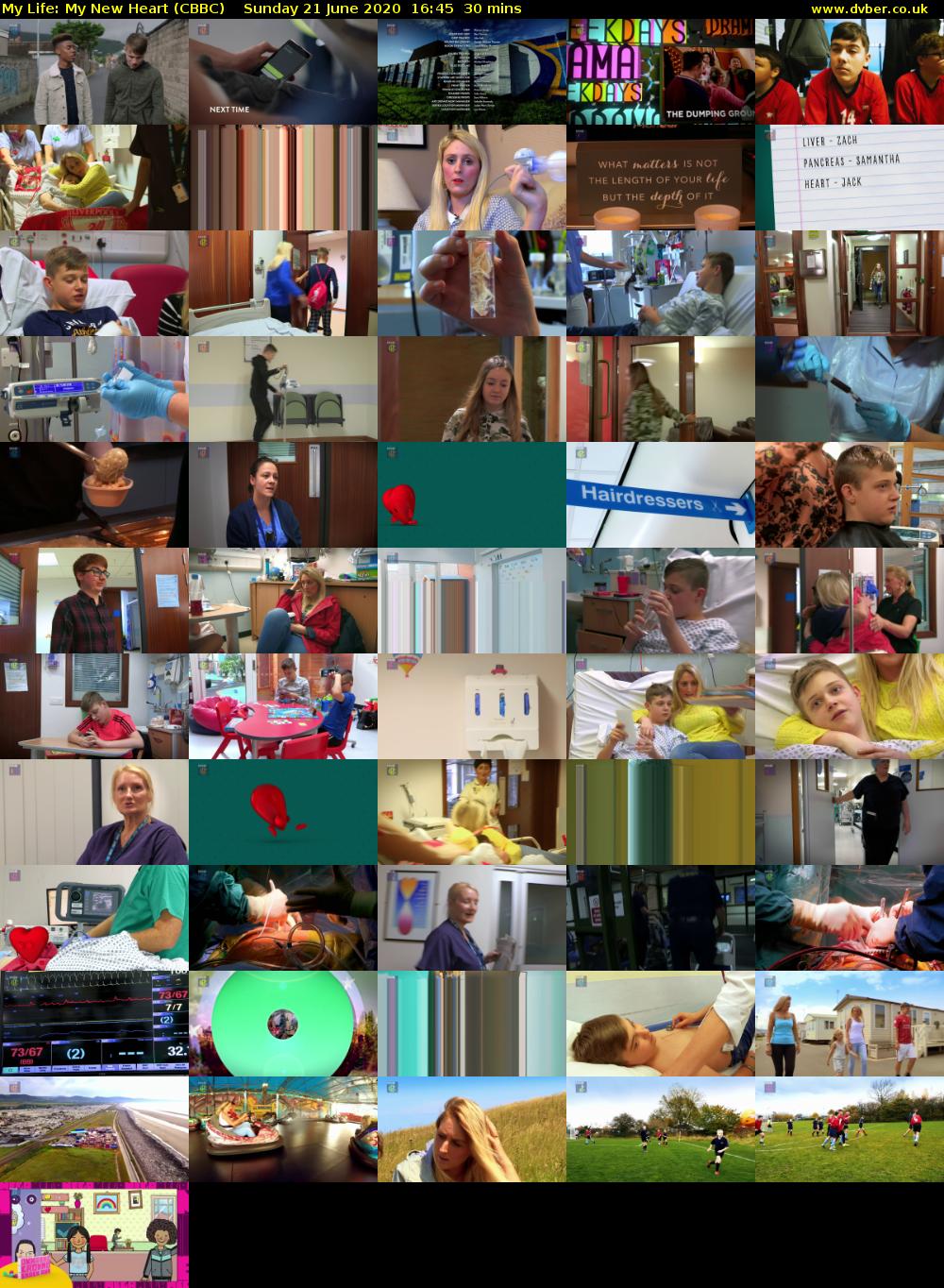 My Life: My New Heart (CBBC) Sunday 21 June 2020 16:45 - 17:15
