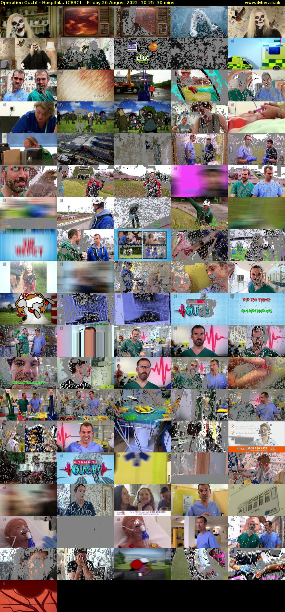 Operation Ouch! - Hospital... (CBBC) Friday 26 August 2022 10:25 - 10:55
