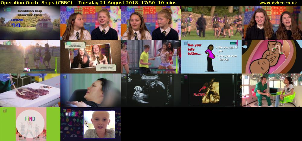 Operation Ouch! Snips (CBBC) Tuesday 21 August 2018 17:50 - 18:00