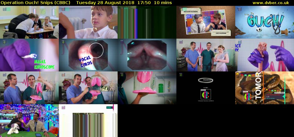 Operation Ouch! Snips (CBBC) Tuesday 28 August 2018 17:50 - 18:00