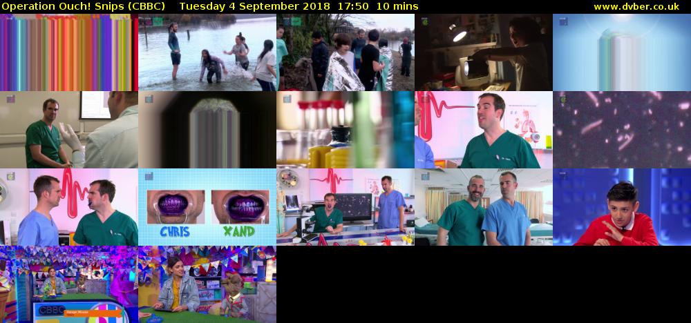 Operation Ouch! Snips (CBBC) Tuesday 4 September 2018 17:50 - 18:00