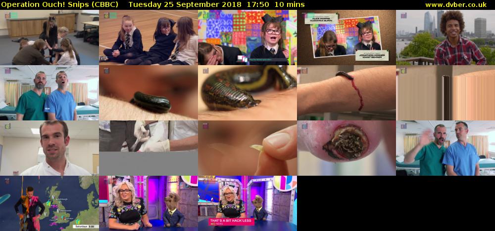 Operation Ouch! Snips (CBBC) Tuesday 25 September 2018 17:50 - 18:00