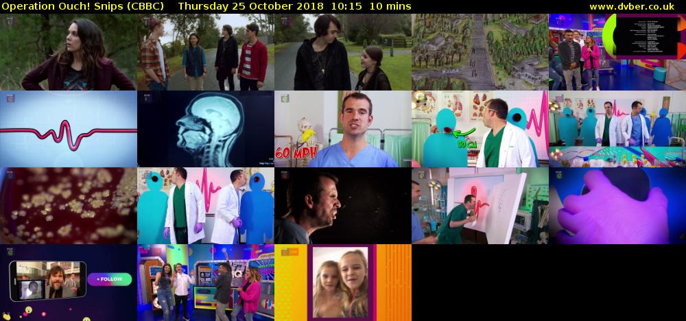 Operation Ouch! Snips (CBBC) Thursday 25 October 2018 10:15 - 10:25