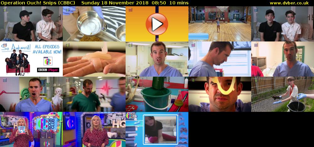 Operation Ouch! Snips (CBBC) Sunday 18 November 2018 08:50 - 09:00
