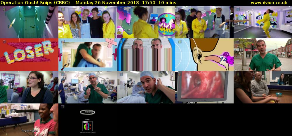 Operation Ouch! Snips (CBBC) Monday 26 November 2018 17:50 - 18:00