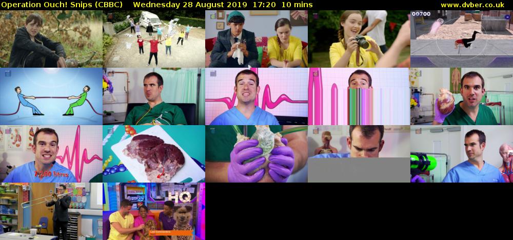 Operation Ouch! Snips (CBBC) Wednesday 28 August 2019 17:20 - 17:30