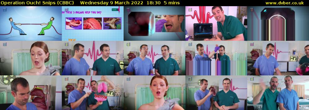 Operation Ouch! Snips (CBBC) Wednesday 9 March 2022 18:30 - 18:35