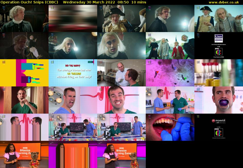 Operation Ouch! Snips (CBBC) Wednesday 30 March 2022 08:50 - 09:00