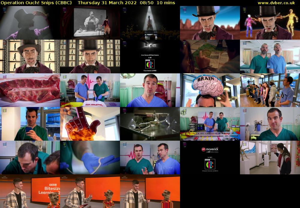 Operation Ouch! Snips (CBBC) Thursday 31 March 2022 08:50 - 09:00