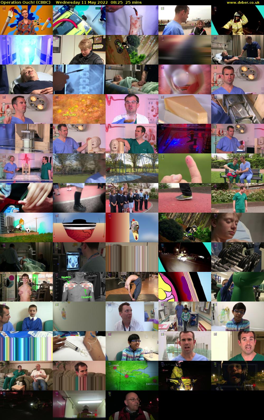 Operation Ouch! (CBBC) Wednesday 11 May 2022 08:25 - 08:50
