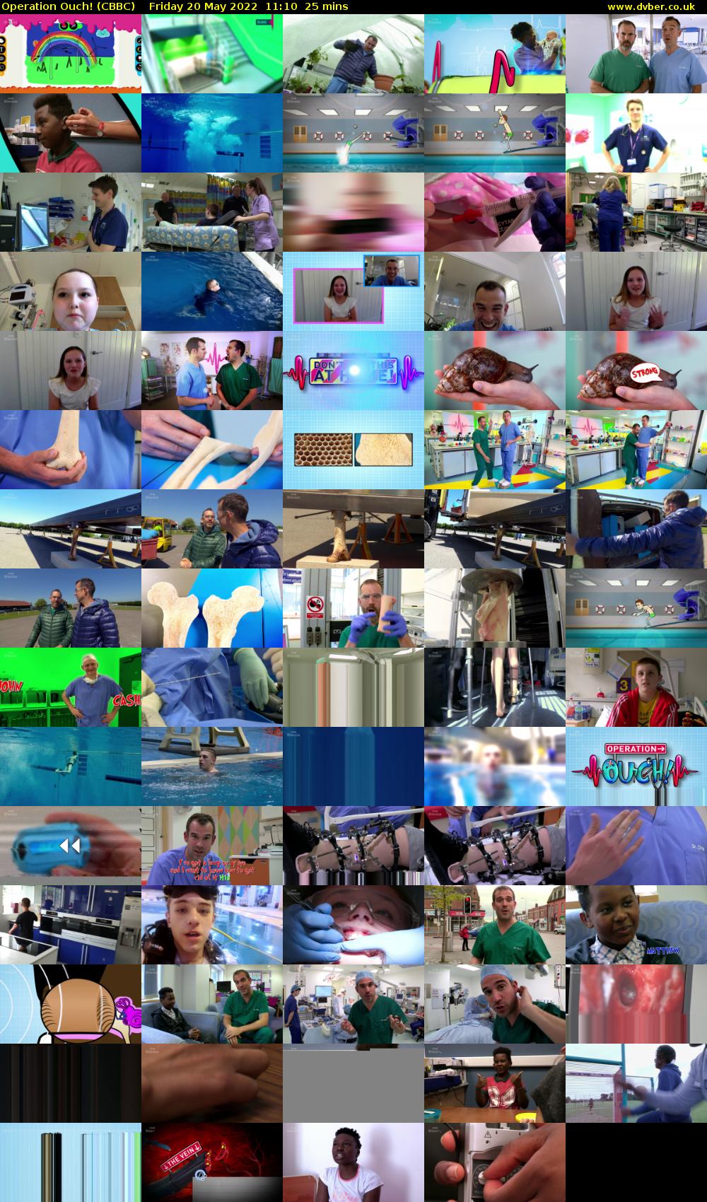 Operation Ouch! (CBBC) Friday 20 May 2022 11:10 - 11:35