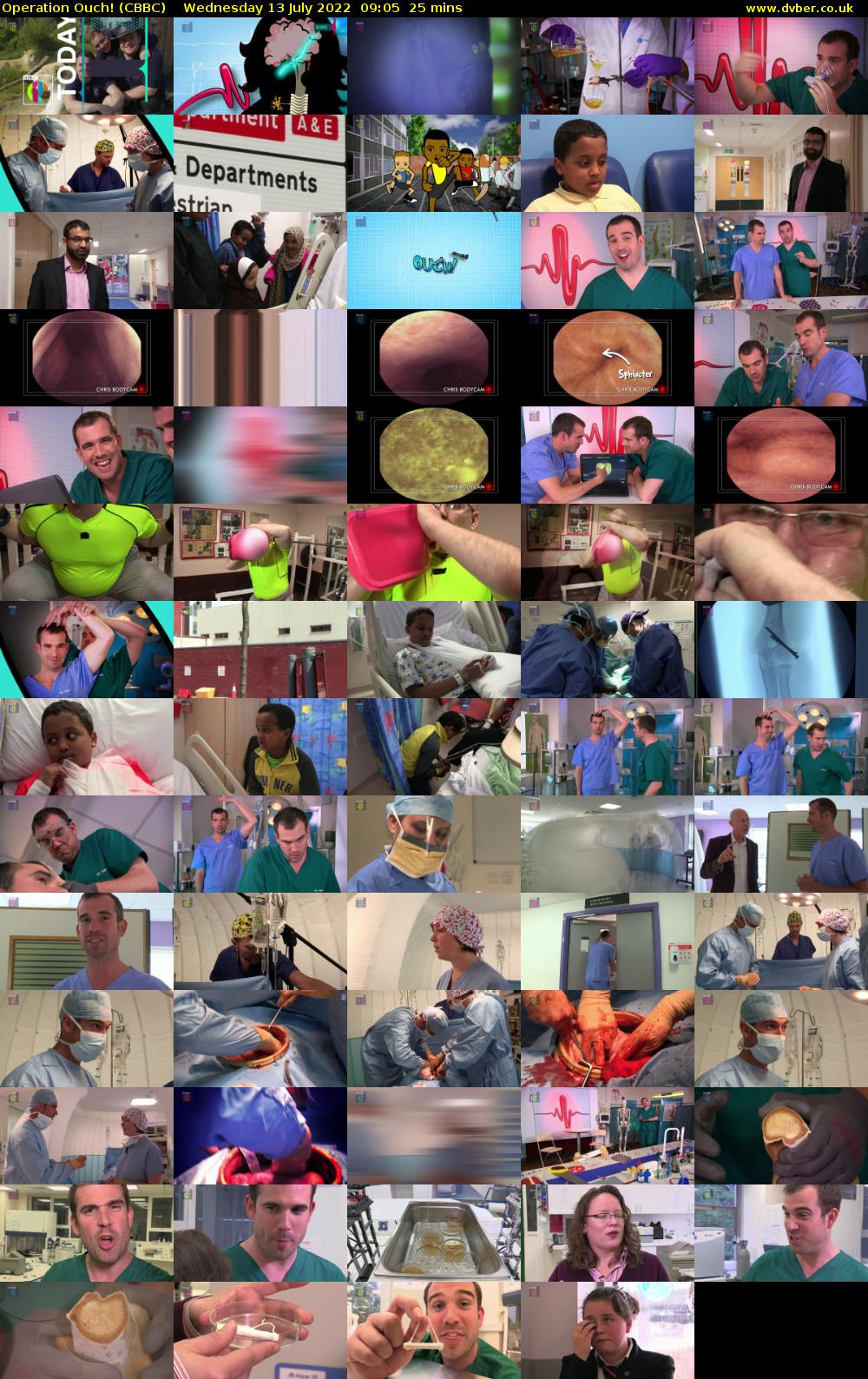 Operation Ouch! (CBBC) Wednesday 13 July 2022 09:05 - 09:30