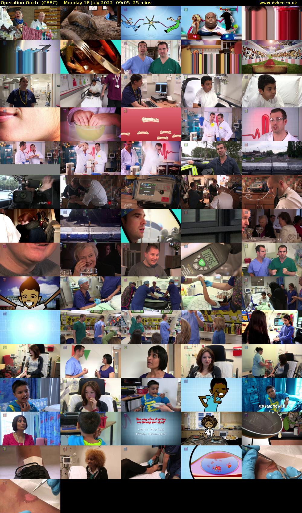 Operation Ouch! (CBBC) Monday 18 July 2022 09:05 - 09:30