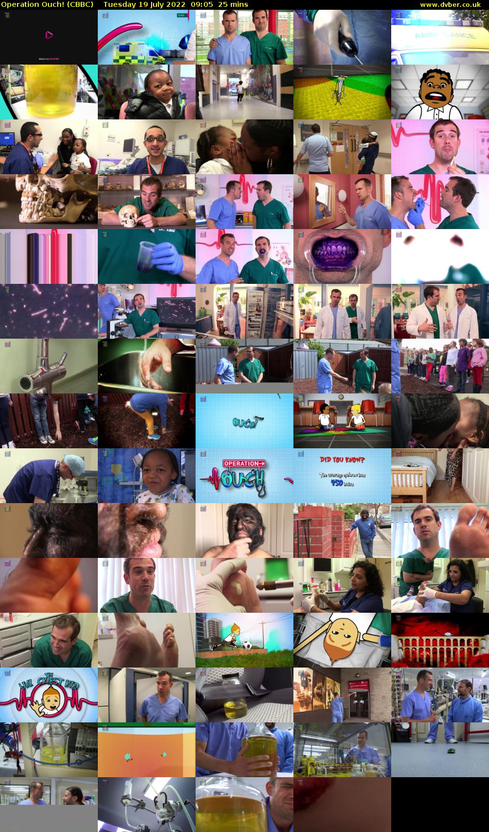 Operation Ouch! (CBBC) Tuesday 19 July 2022 09:05 - 09:30
