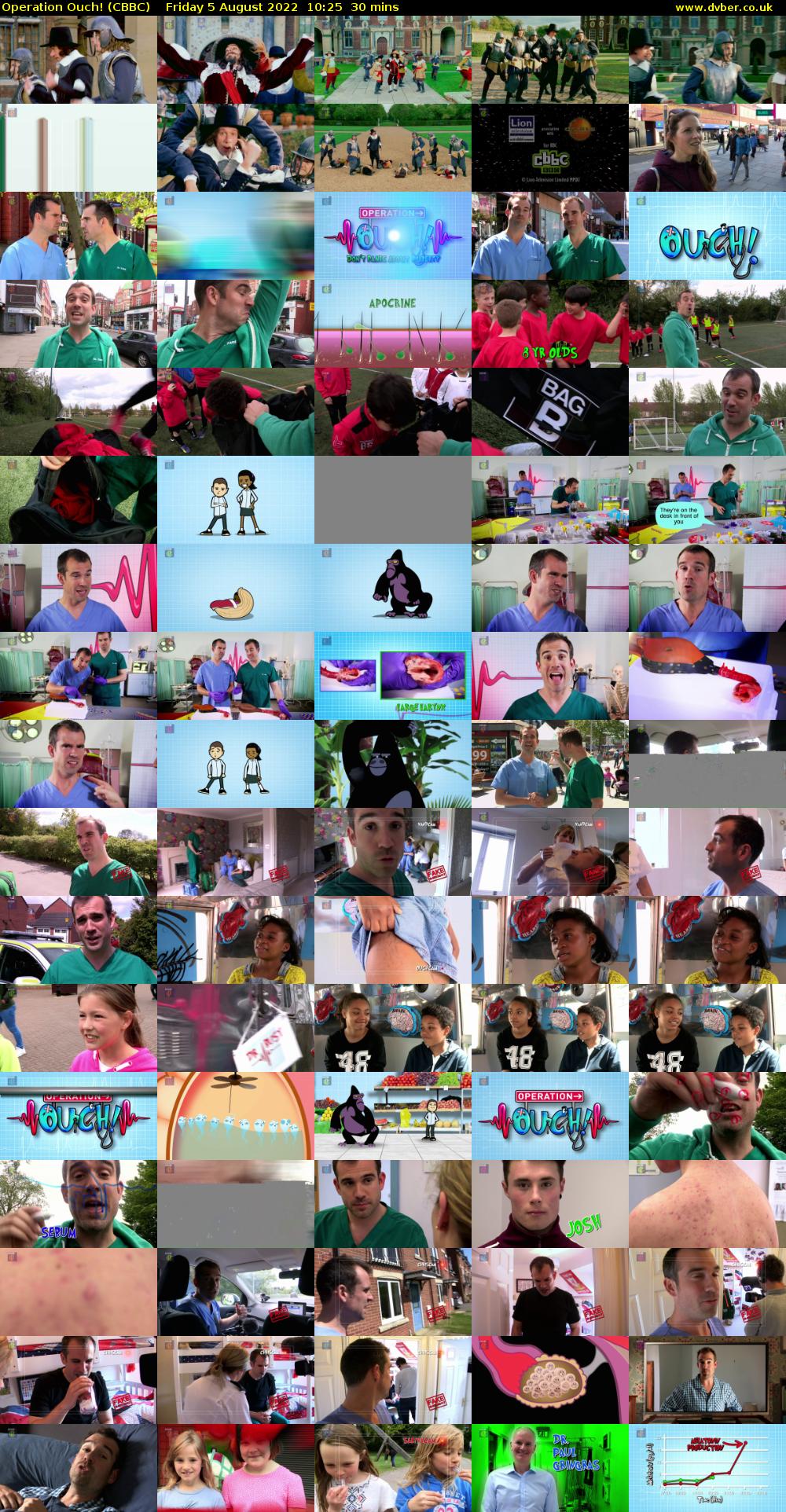 Operation Ouch! (CBBC) Friday 5 August 2022 10:25 - 10:55