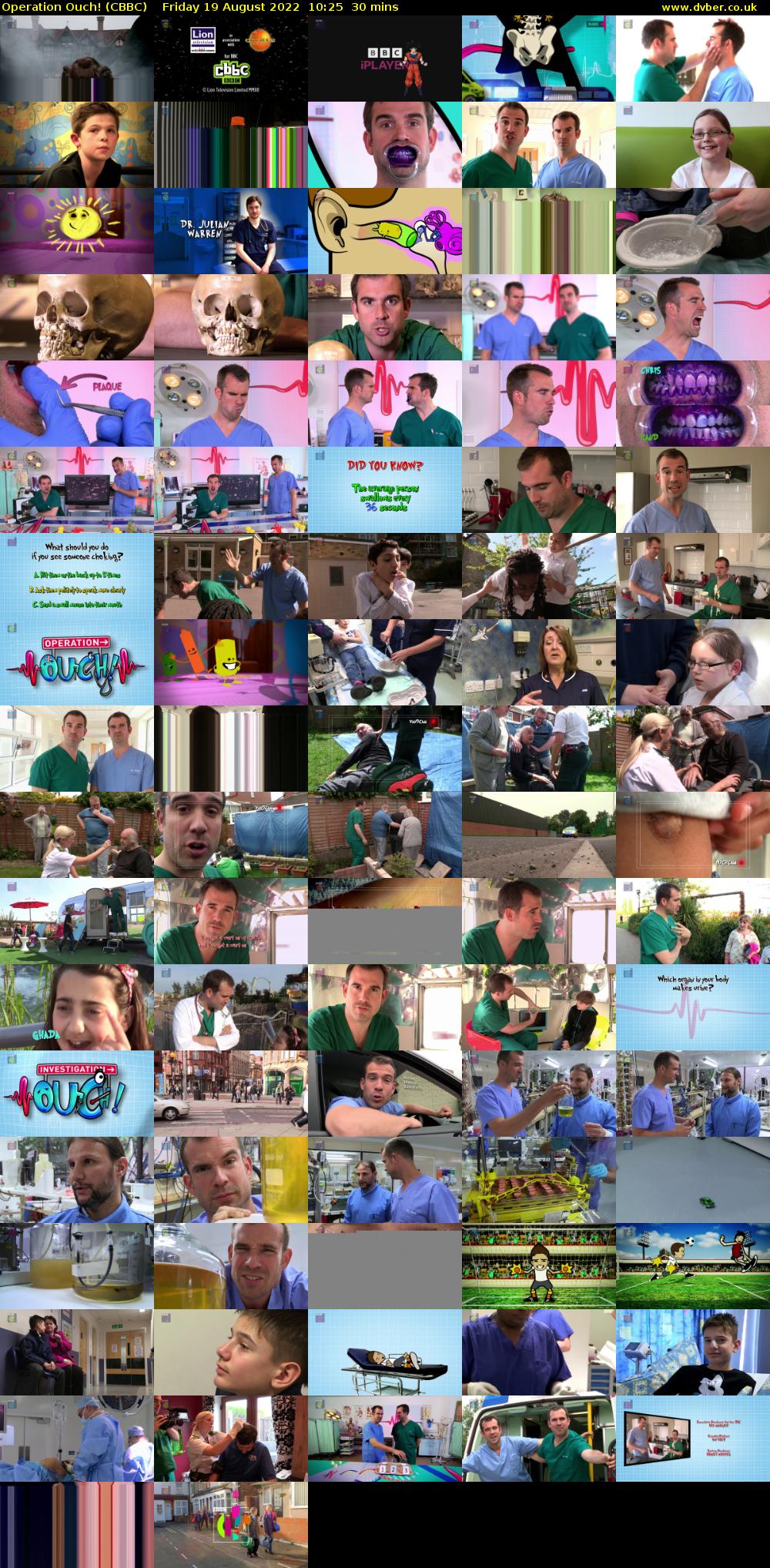Operation Ouch! (CBBC) Friday 19 August 2022 10:25 - 10:55