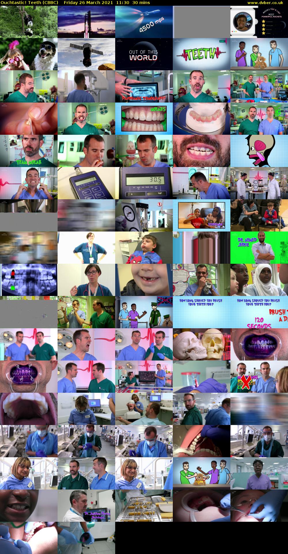 Ouchtastic! Teeth (CBBC) Friday 26 March 2021 11:30 - 12:00