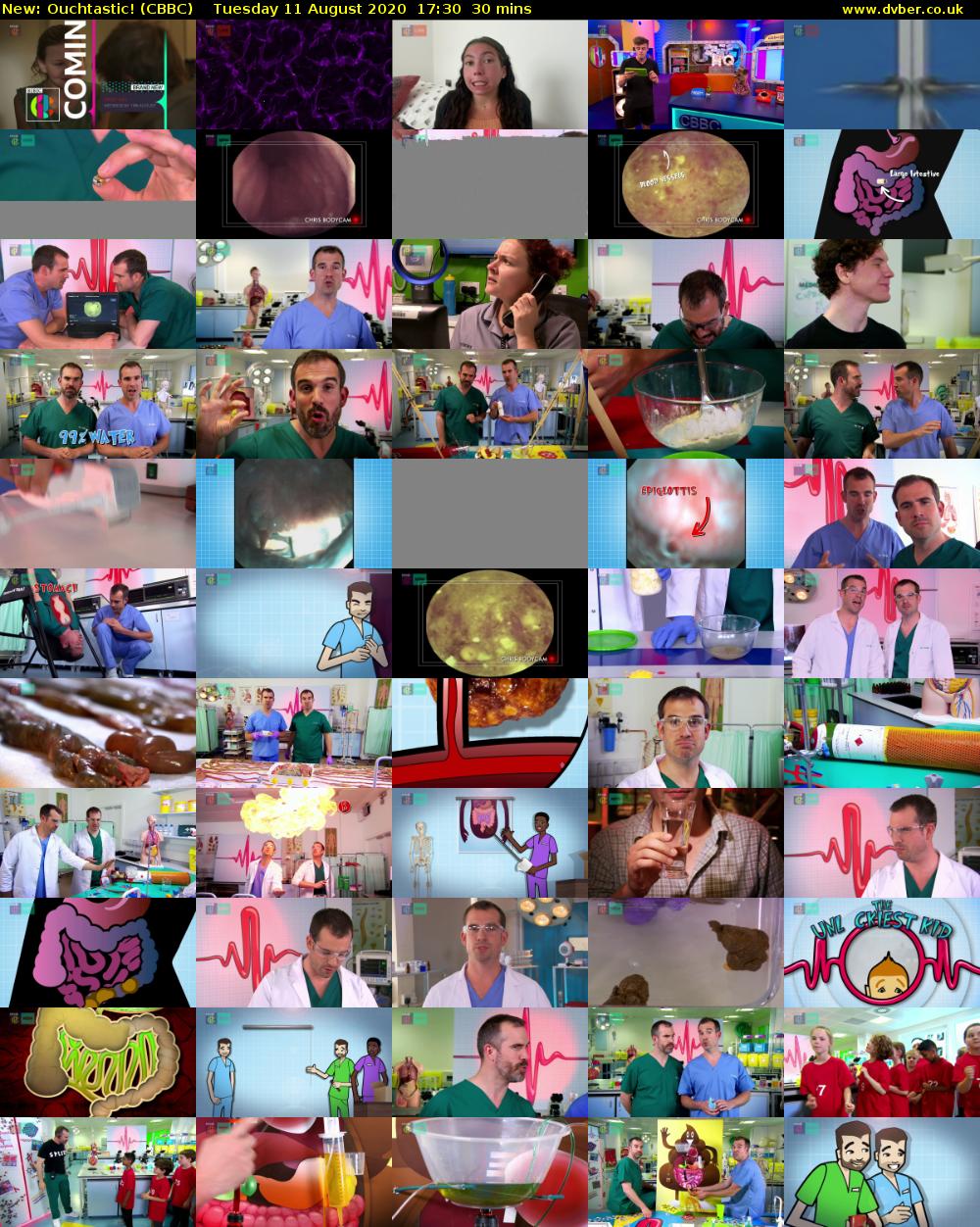 Ouchtastic! (CBBC) Tuesday 11 August 2020 17:30 - 18:00
