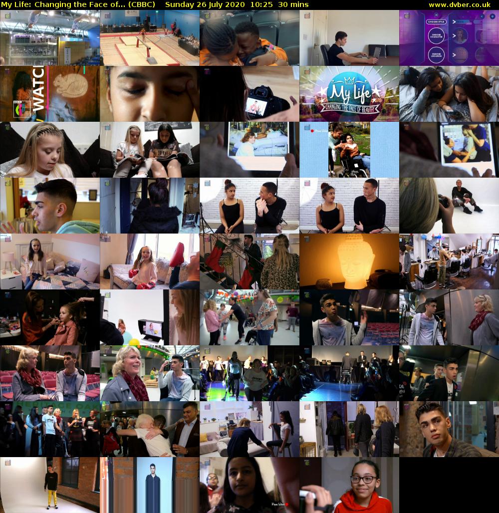 My Life: Changing the Face of... (CBBC) Sunday 26 July 2020 10:25 - 10:55