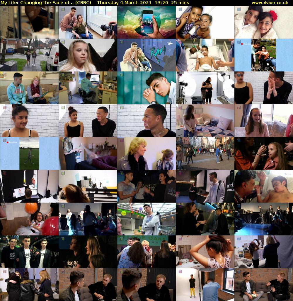 My Life: Changing the Face of... (CBBC) Thursday 4 March 2021 13:20 - 13:45