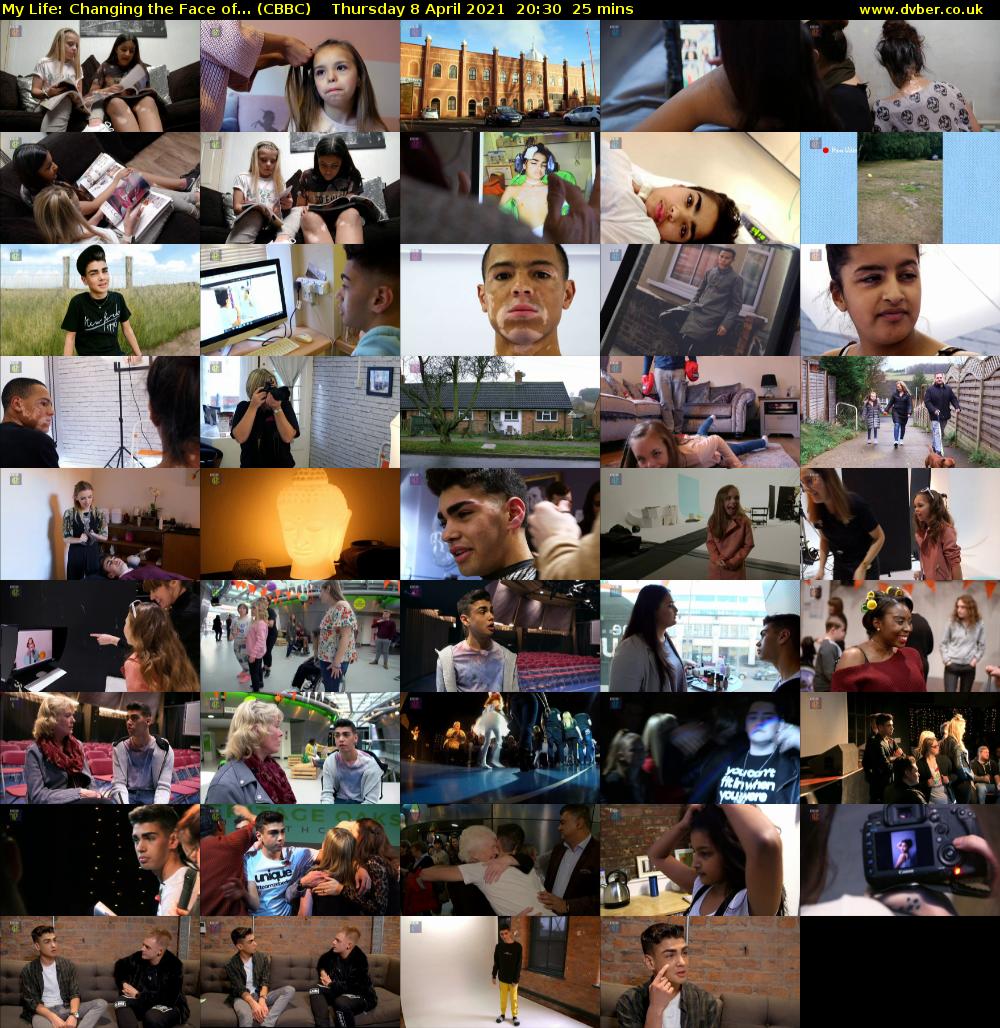 My Life: Changing the Face of... (CBBC) Thursday 8 April 2021 20:30 - 20:55