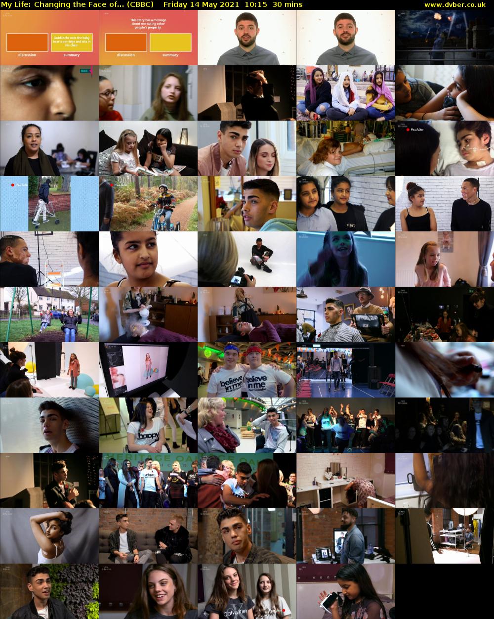 My Life: Changing the Face of... (CBBC) Friday 14 May 2021 10:15 - 10:45