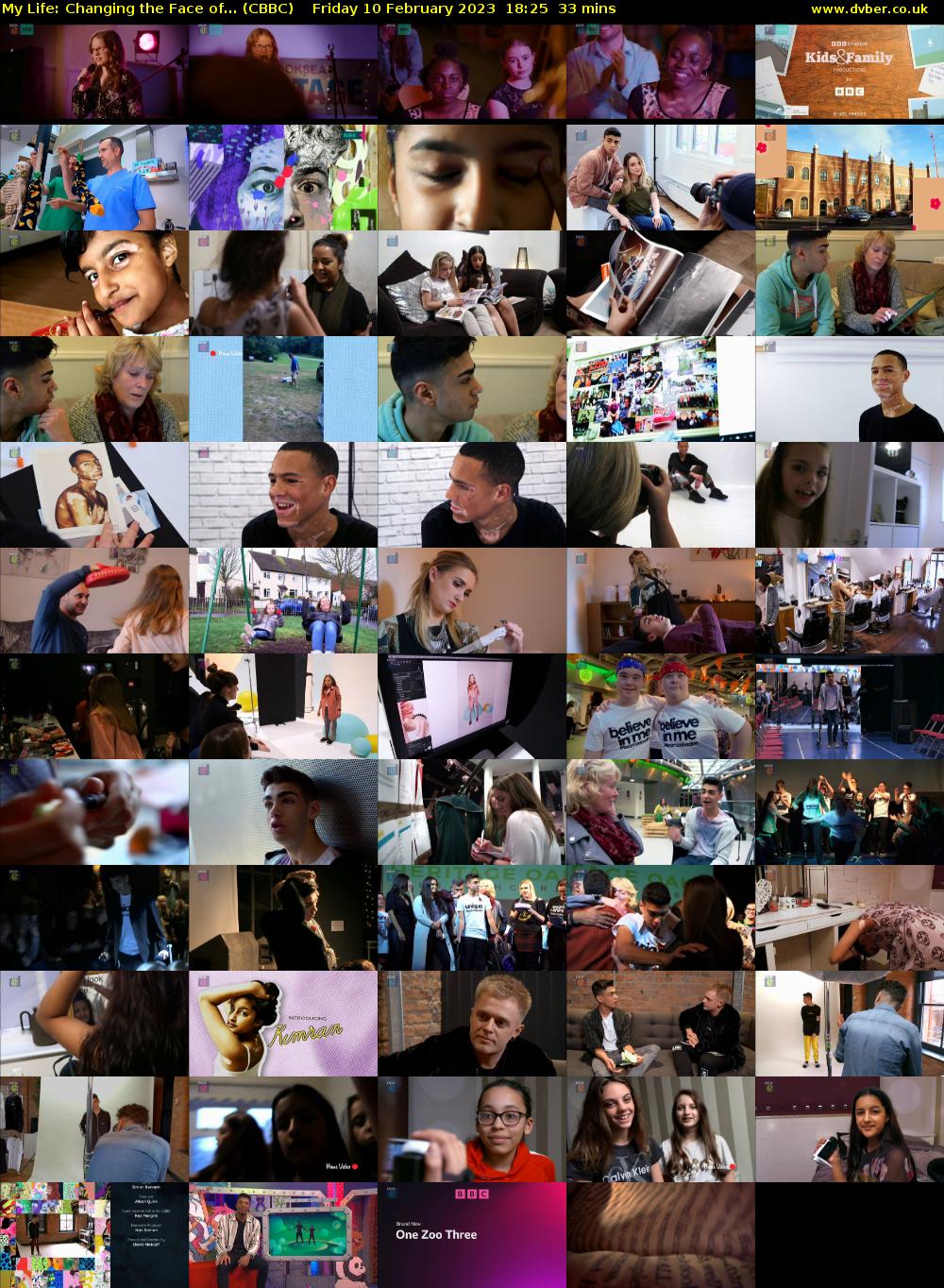 My Life: Changing the Face of... (CBBC) Friday 10 February 2023 18:25 - 18:58