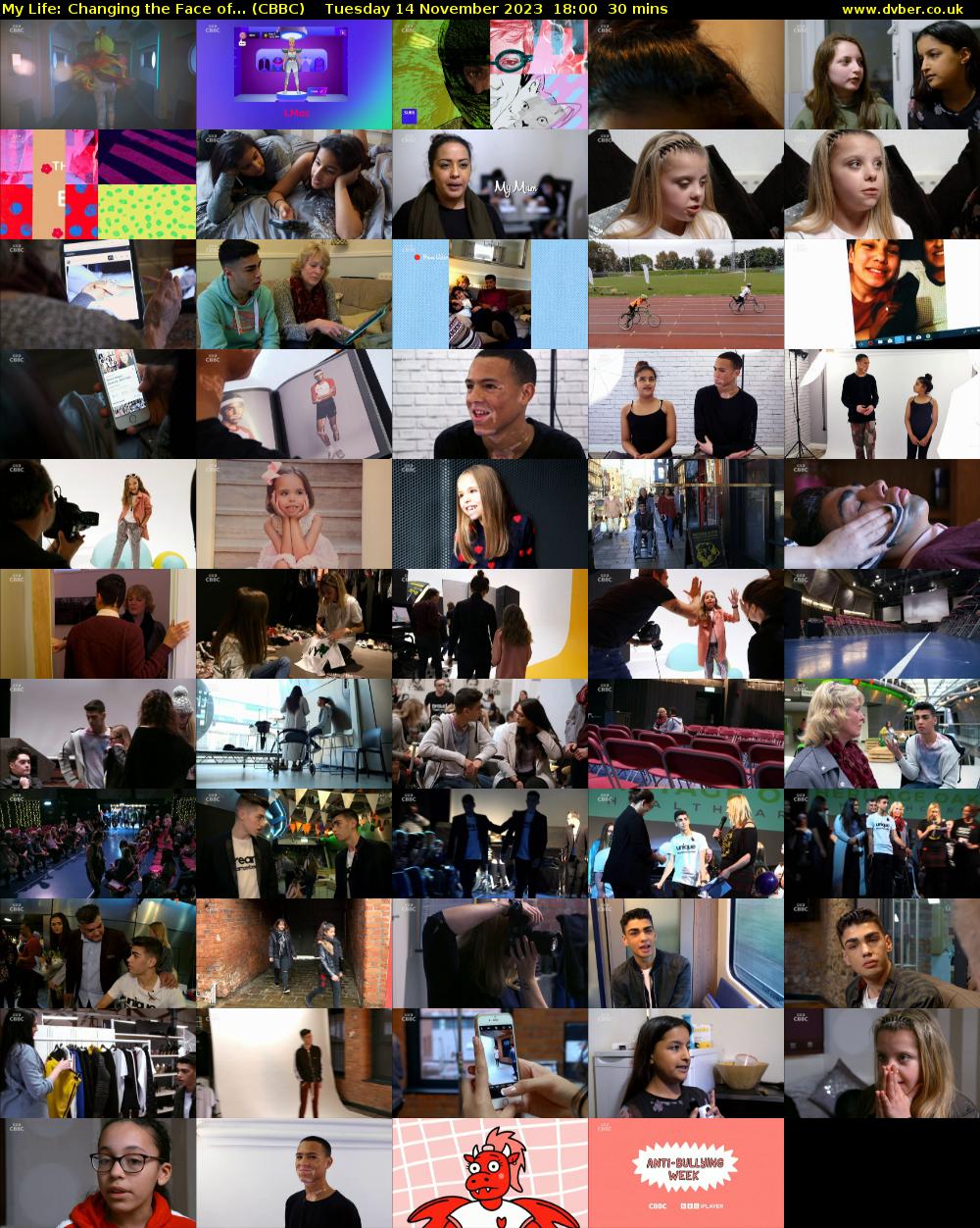 My Life: Changing the Face of... (CBBC) Tuesday 14 November 2023 18:00 - 18:30