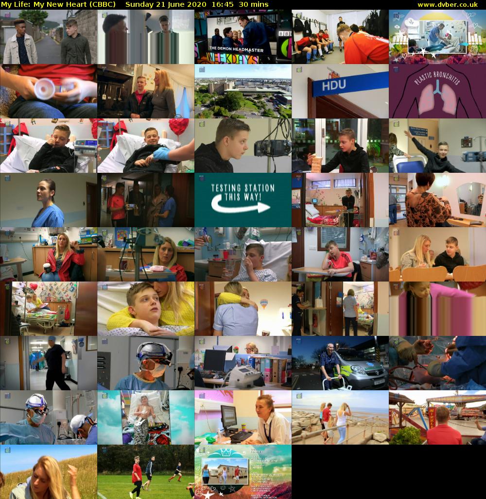 My Life: My New Heart (CBBC) Sunday 21 June 2020 16:45 - 17:15