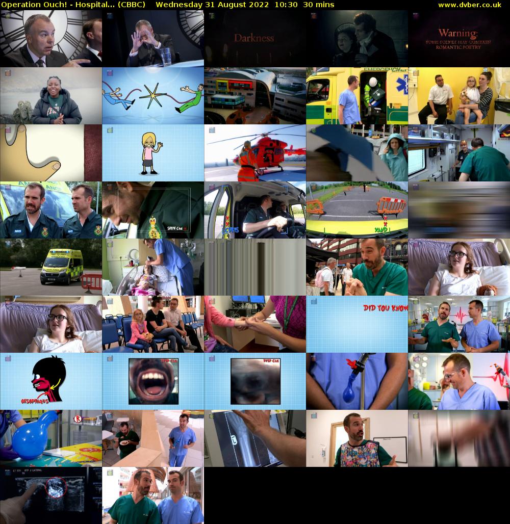 Operation Ouch! - Hospital... (CBBC) Wednesday 31 August 2022 10:30 - 11:00