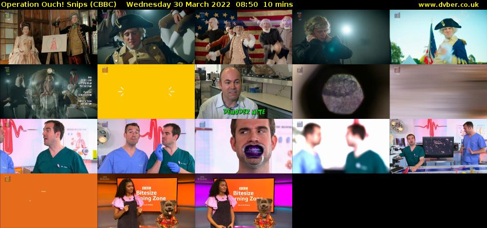 Operation Ouch! Snips (CBBC) Wednesday 30 March 2022 08:50 - 09:00