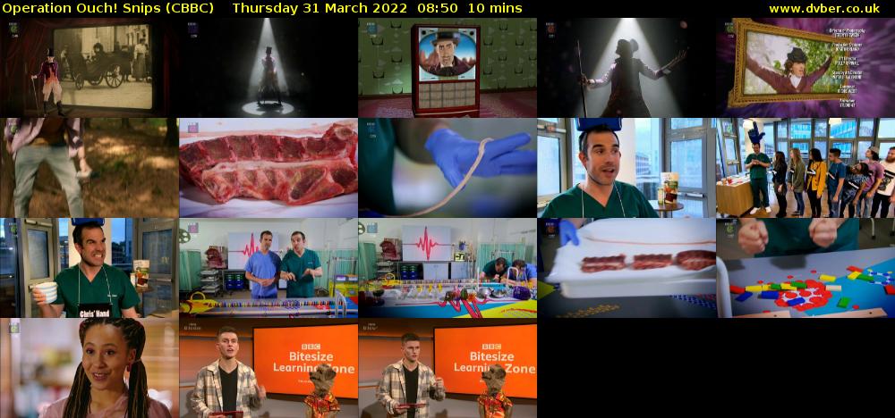 Operation Ouch! Snips (CBBC) Thursday 31 March 2022 08:50 - 09:00