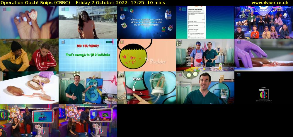 Operation Ouch! Snips (CBBC) Friday 7 October 2022 17:25 - 17:35