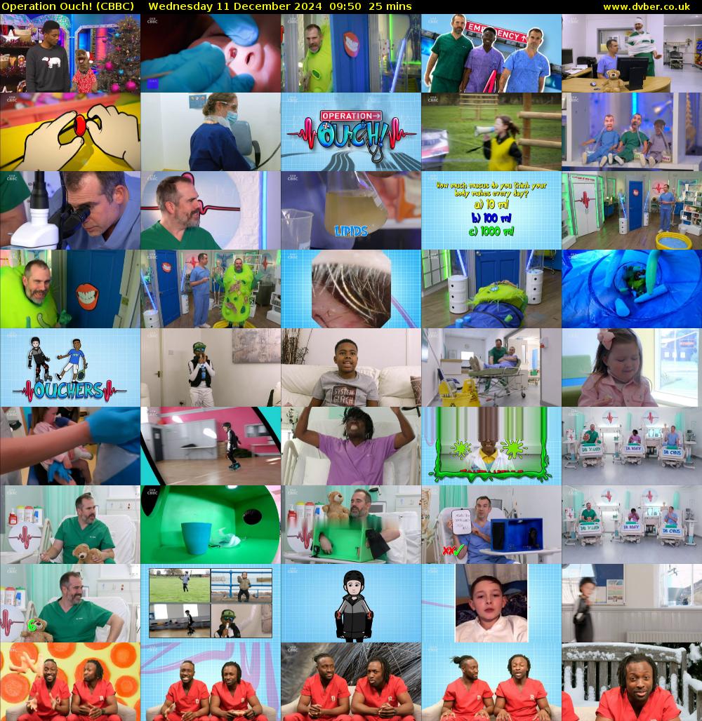 Operation Ouch! (CBBC) Wednesday 11 December 2024 09:50 - 10:15