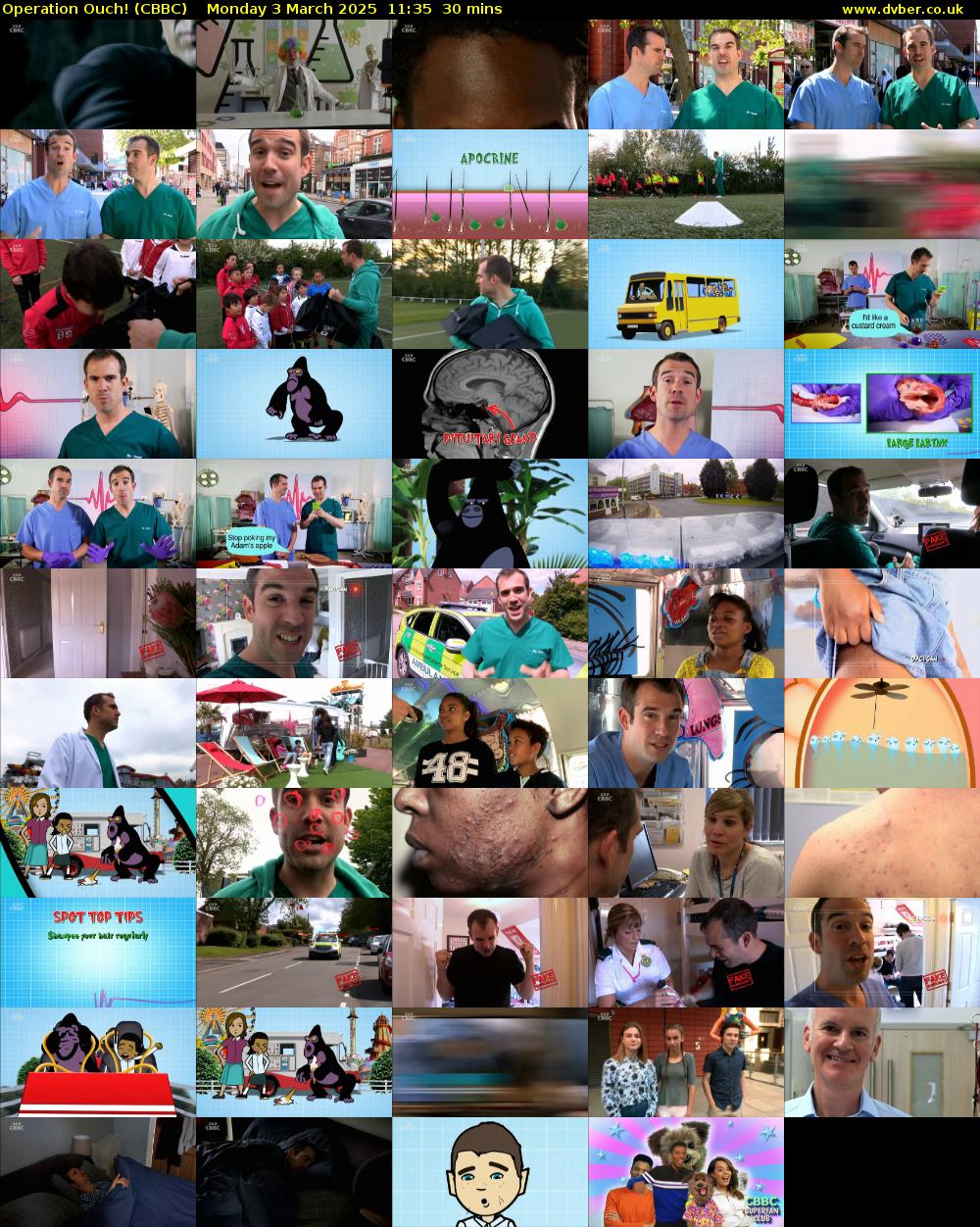 Operation Ouch! (CBBC) Monday 3 March 2025 11:35 - 12:05