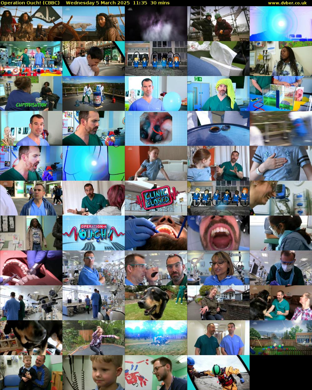 Operation Ouch! (CBBC) Wednesday 5 March 2025 11:35 - 12:05