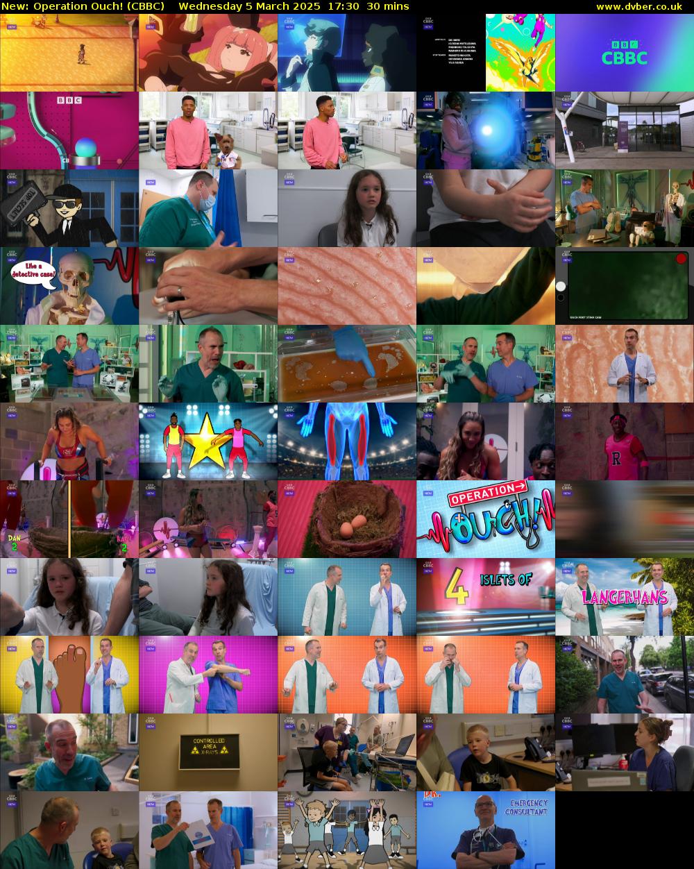 Operation Ouch! (CBBC) Wednesday 5 March 2025 17:30 - 18:00