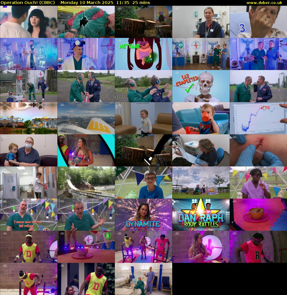 Operation Ouch! (CBBC) Monday 10 March 2025 11:35 - 12:00