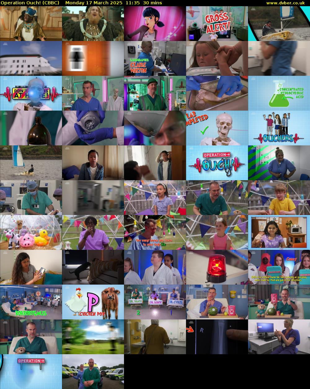 Operation Ouch! (CBBC) Monday 17 March 2025 11:35 - 12:05