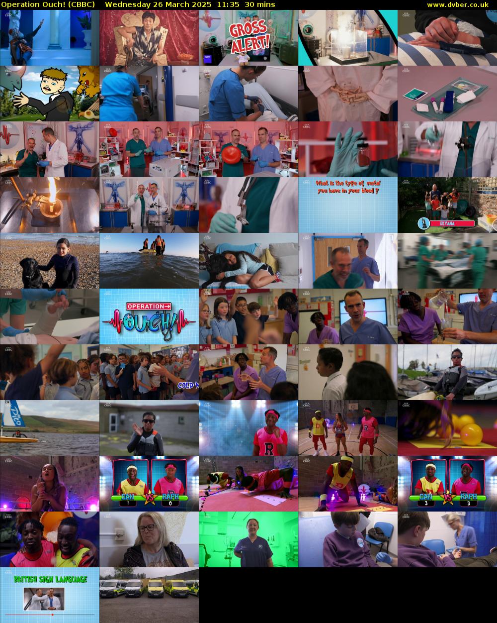 Operation Ouch! (CBBC) Wednesday 26 March 2025 11:35 - 12:05