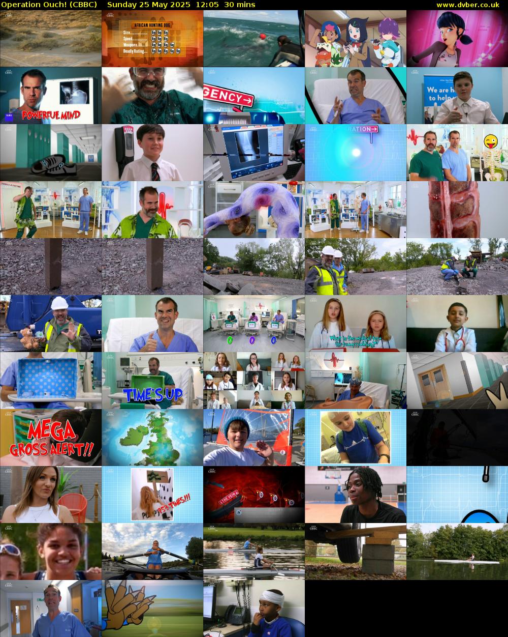 Operation Ouch! (CBBC) Sunday 25 May 2025 12:05 - 12:35