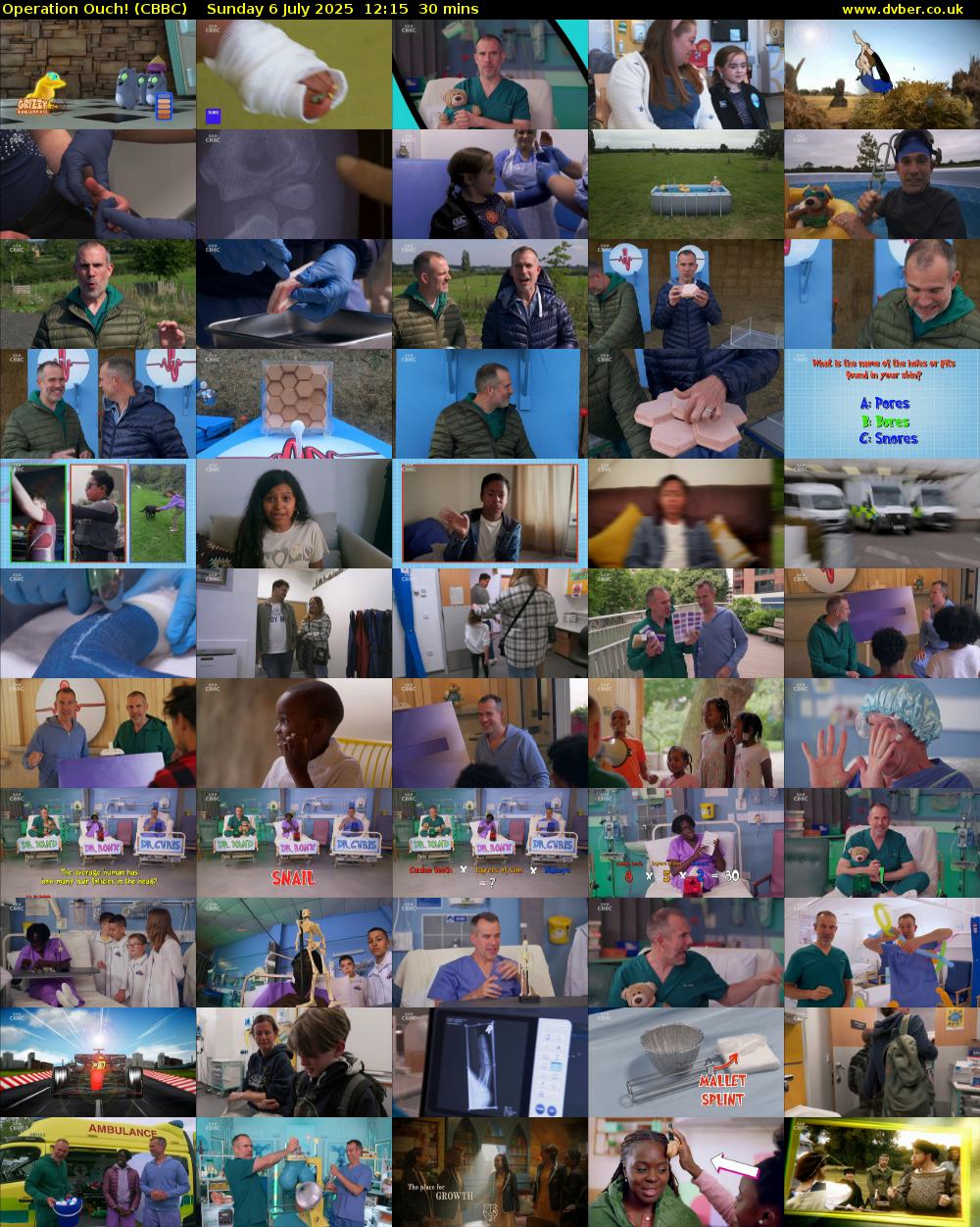 Operation Ouch! (CBBC) Sunday 6 July 2025 12:15 - 12:45
