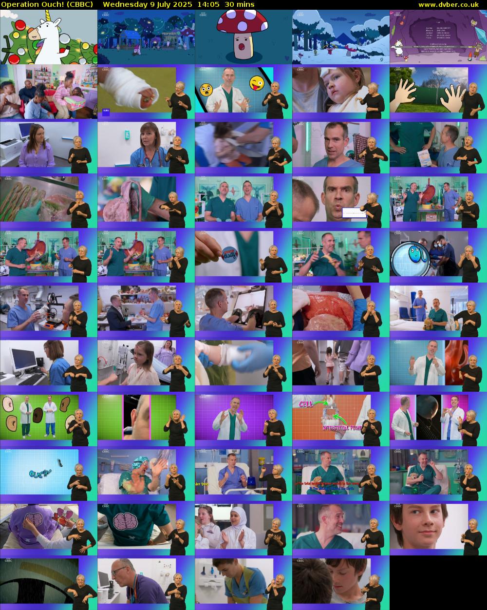 Operation Ouch! (CBBC) Wednesday 9 July 2025 14:05 - 14:35