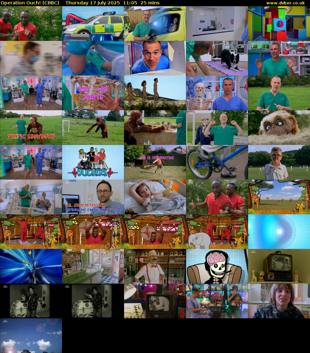 Operation Ouch! (CBBC) Thursday 17 July 2025 11:05 - 11:30
