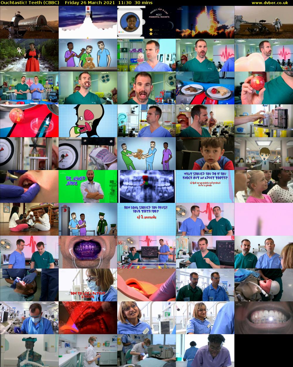 Ouchtastic! Teeth (CBBC) Friday 26 March 2021 11:30 - 12:00
