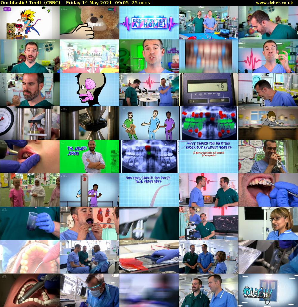 Ouchtastic! Teeth (CBBC) Friday 14 May 2021 09:05 - 09:30