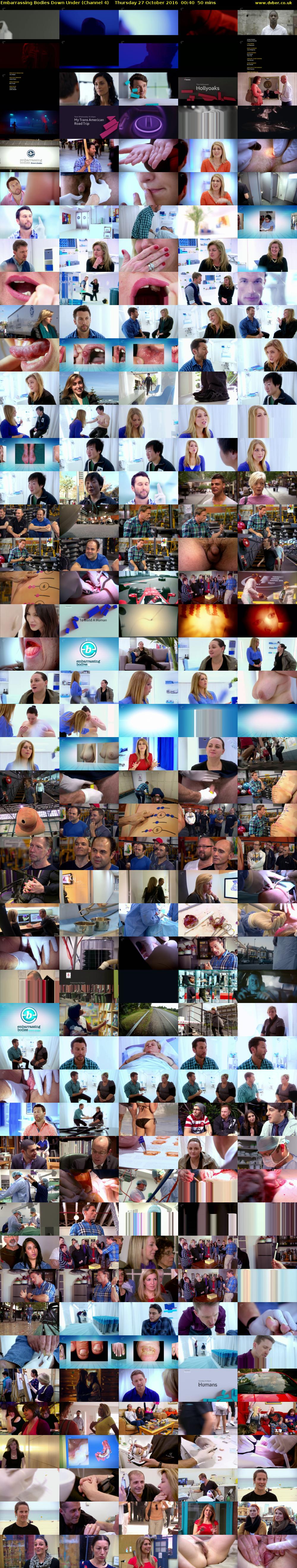 Embarrassing Bodies Down Under (Channel 4) Thursday 27 October 2016 00:40 - 01:30
