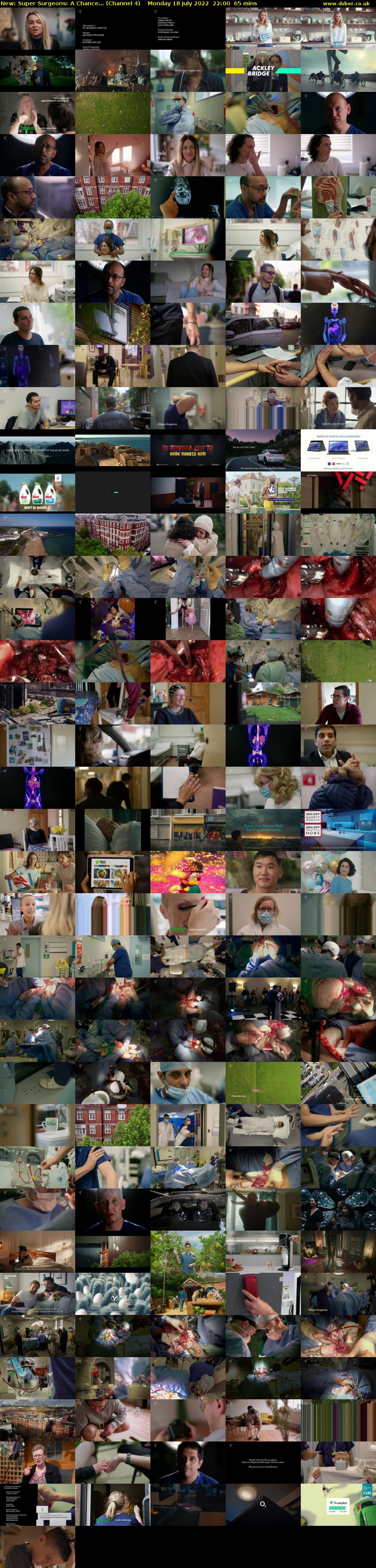 Super Surgeons: A Chance... (Channel 4) Monday 18 July 2022 22:00 - 23:05